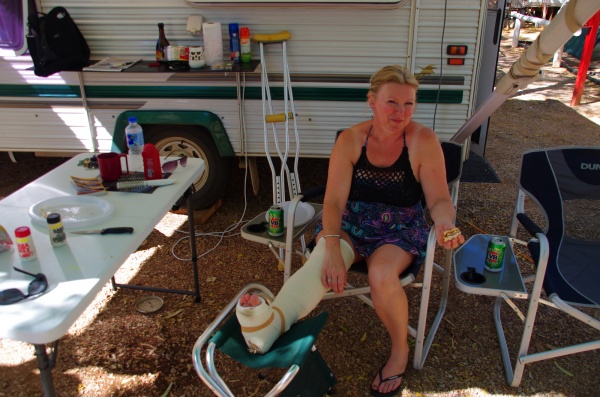 Derby - Deb brakes her ankle stepping out of the Van.
